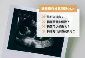 美國捐卵常見問題QA