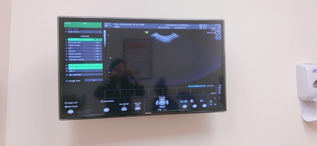 美國捐卵可獲得8000美金,機票補助,加州住宿全免. 捐卵條件： 29歲以下 155公分以上 高中大學畢