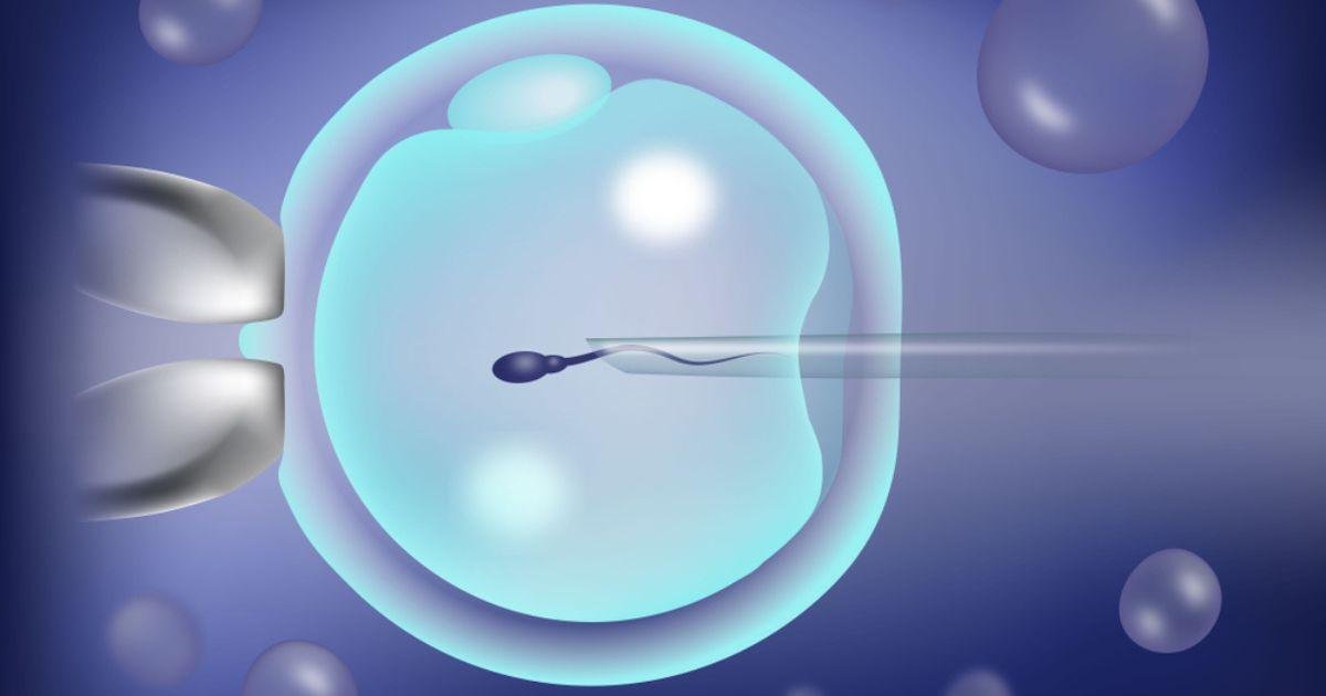 Step 5 – 卵子和精子取出